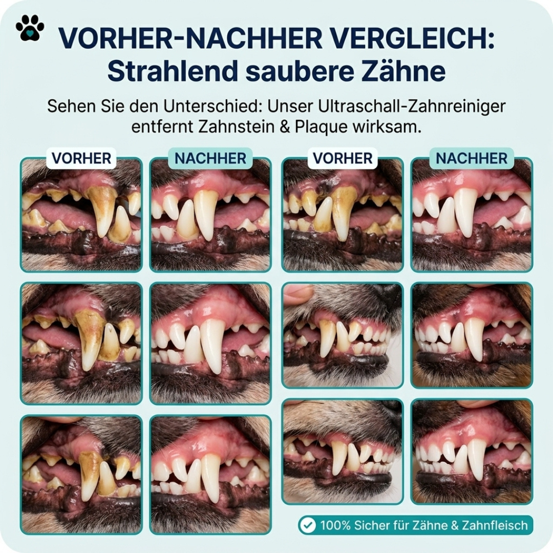 Pawnella SauberZahn Ultraschall-Zahnreiniger 5